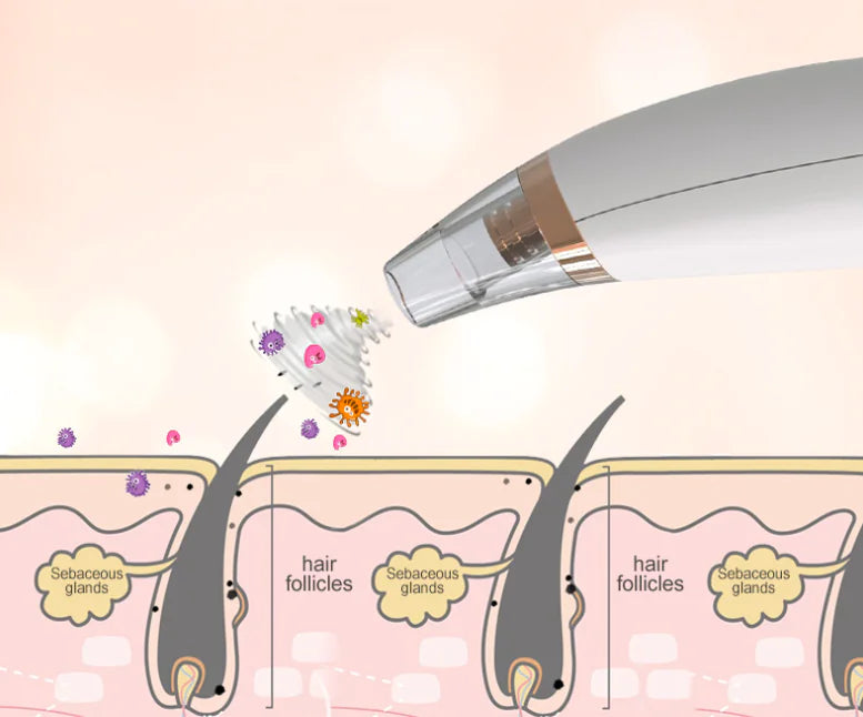 Powerful Electric Blackhead Remover for Home Use